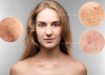 semundjet e lekures quick albania