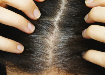 thinjat e parakohshme quick albania